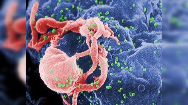 Virus HIV AIDS